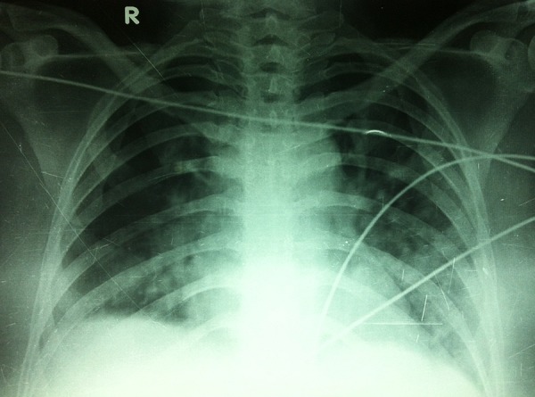 Figure 2