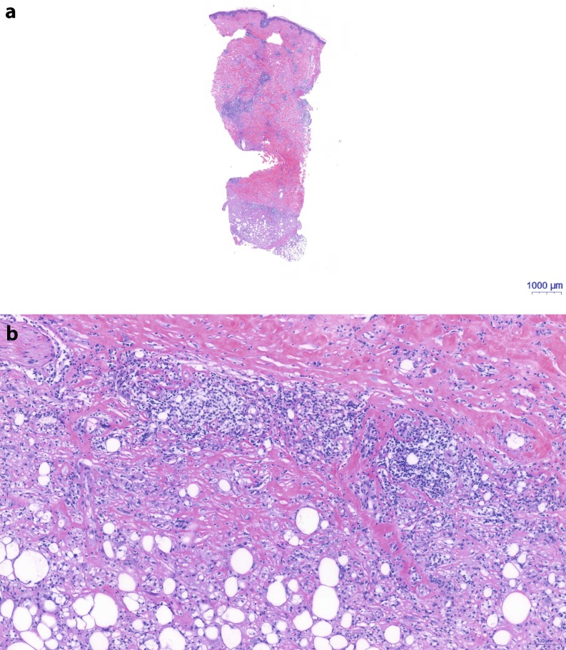 Fig. 2