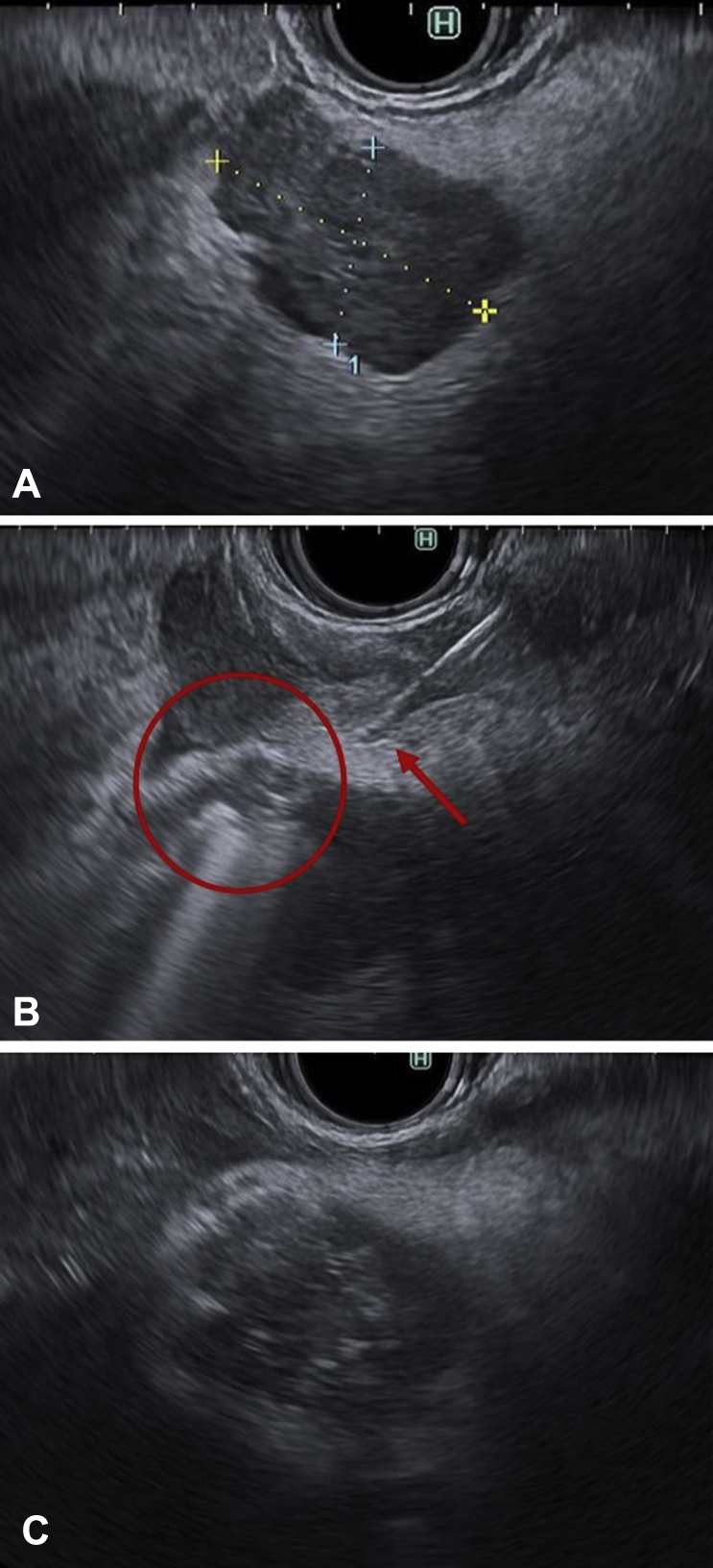 Figure 1