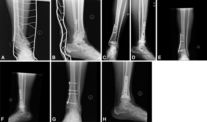 Fig. 1A–H