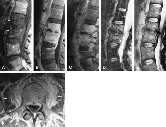 fig 3.