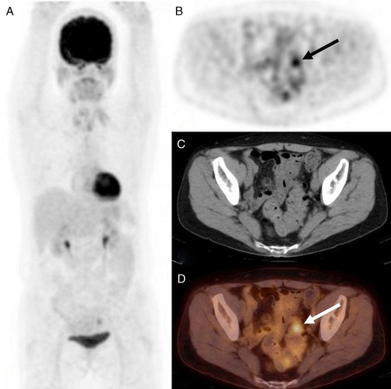 FIGURE 3