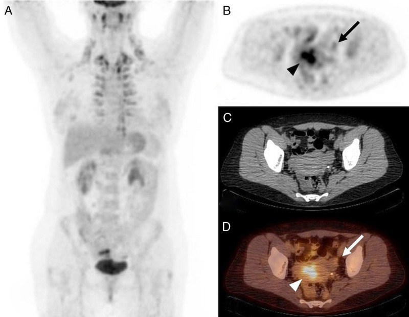 FIGURE 4