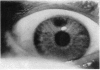 374-1