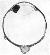 374-1