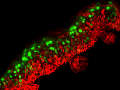 Transgenic epidermis expressing Snail (red) results in expanded keratin 1 expression (green)