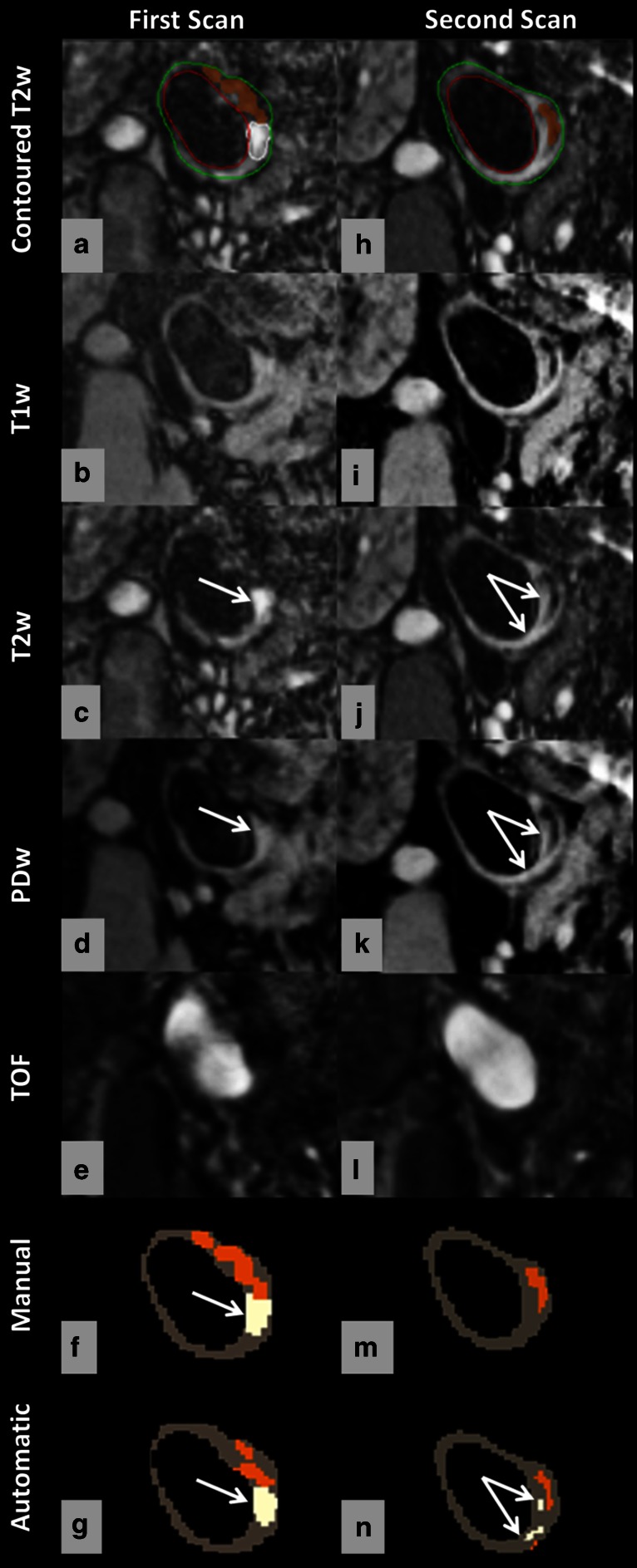 Fig. 5