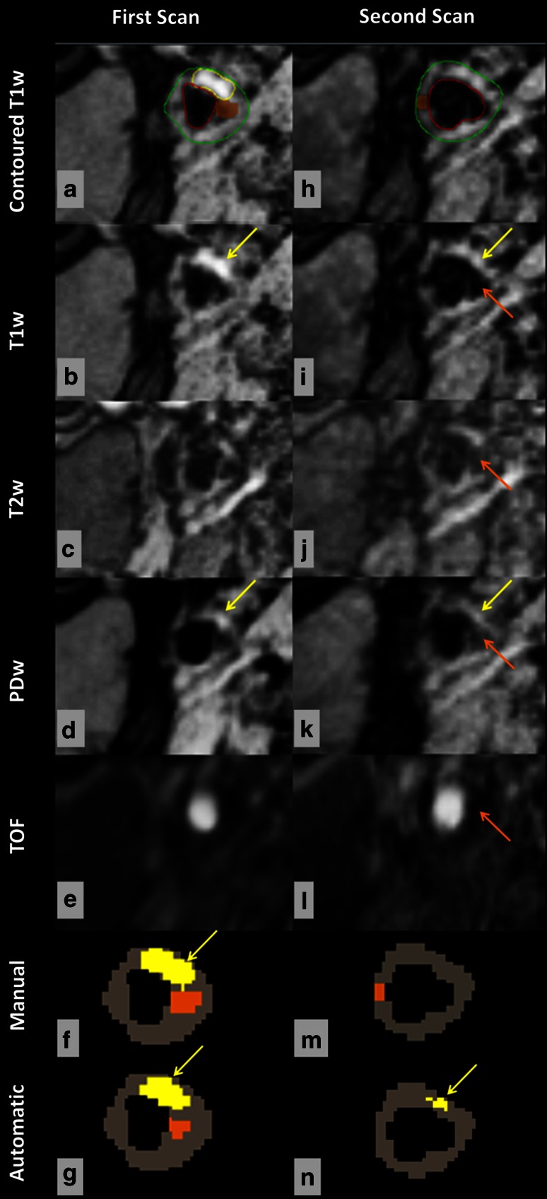 Fig. 6