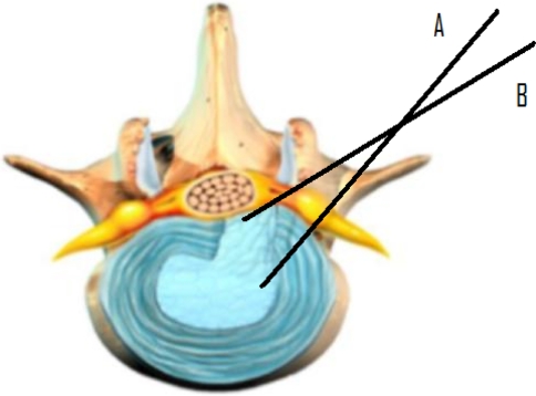 Fig. 1