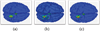 Fig.1