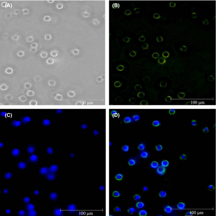 FIGURE 3