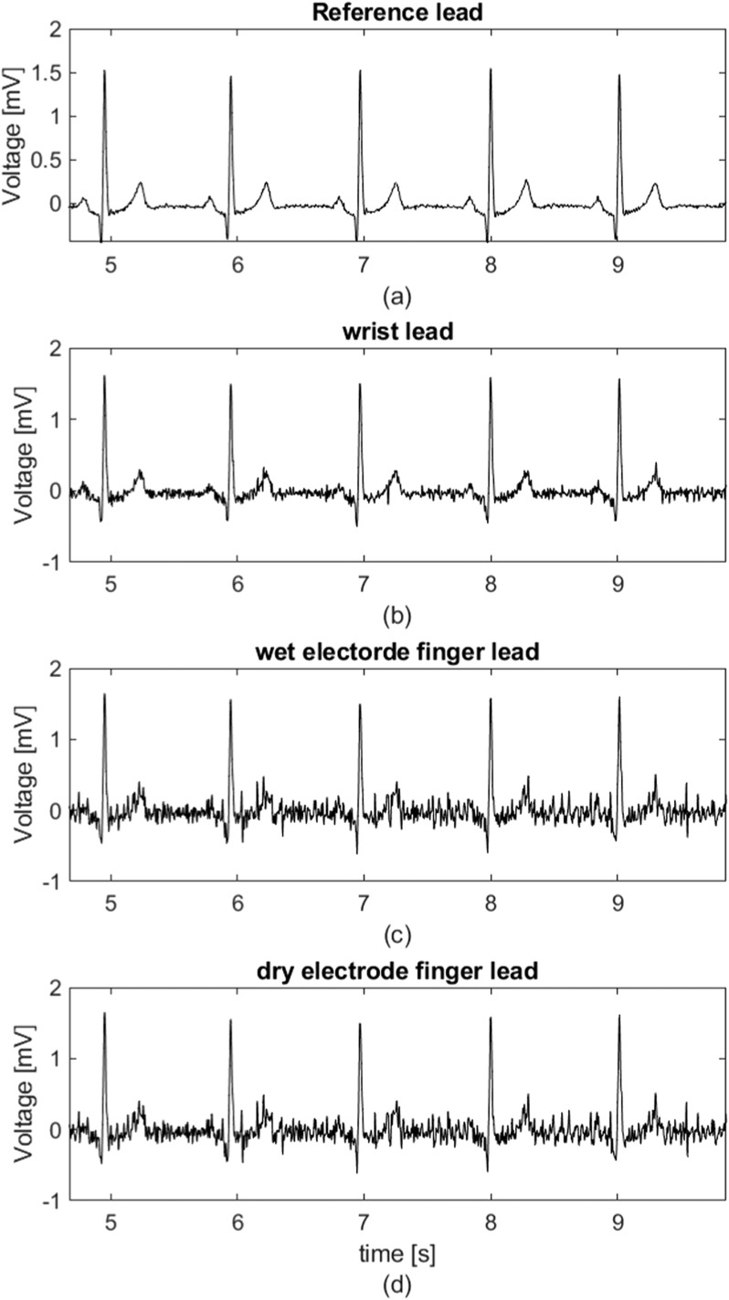 Fig. 2.