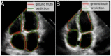 Fig 12