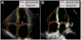 Fig 14