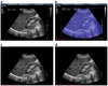 Fig 2