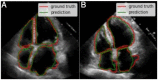 Fig 15