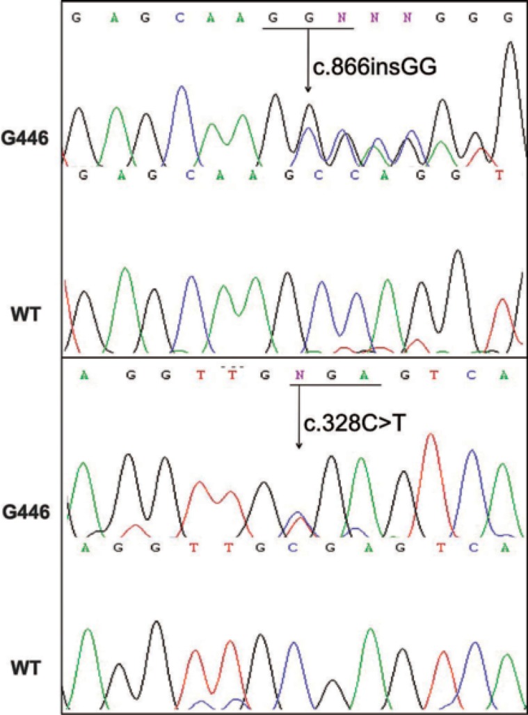 FIGURE 4