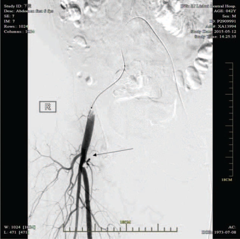 FIGURE 2