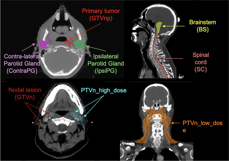 Figure 1