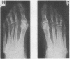 254