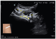 Figure 13.