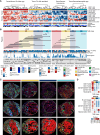 Figure 2. Four TME classes in NSCLC defined by immune composition in tumor nests and surrounding stroma. A, Tumor cores were classified into four TME classes, derived by clustering immune cell densities in the tumor nest and stroma. Only LUAD (n = 65 cores, 35 tumors) and LUSC (n = 48, 23 tumors) tumor cores are featured, and corresponding clinical annotations are displayed. Regional growth patterns are shown for LUAD: lepidic (low grade), acinar and papillary (mid-grade), solid and cribriform (high grade). B, TME classifications displayed separately for LUAD and LUSC. Numbers indicate the number of cores with a given TME class for each histology subtype. The barplot shows the total expressed neoantigen count for all predicted HLA alleles in the range 0–269 for LUAD and 23–160 for LUSC, colored by their clonal and subclonal status. Horizontal lines connect tumor cores from the same multiregion tumor (n = 33 tumors). The annotation bars display tumor genomic features and PD-L1 tumor cell (TC) staining (SP142 IHC) for the corresponding tumor cores. C, Composite images and cell type maps of representative examples for each TME class. Crop insets are 82 μm in diameter. D, A heat map of T values derived from an LMEM of the major cell type density across TME classes, adjusted for histology subtype as a fixed effect and patient as a random effect. Significant relationships are indicated with an asterisk for P ≤ 0.05. TIL, tumor-infiltrating lymphocyte; MΦ, macrophage; LUAD, lung adenocarcinoma; LUSC, lung squamous cell carcinoma; NSCLC, non–small cell lung cancer; TME, tumor microenvironment; TMB, tumor mutation burden; muts/Mb, mutations per megabase; panCK, pancytokeratin; LMEM, linear mixed effects model.
