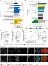 Figure 4. Neutrophil infiltration in LUSC is associated with distinct metabolic and immunosuppressive phenotypes. A, Gene Ontology (GO) biological processes enriched among upregulated genes in the TS:Neutrophil high TME class (n = 10 cores) compared with other TME classes combined (n = 28 cores) in LUSC (FDR < 0.01, gene ratio > 0.05). B, GSEA of hallmark gene sets compared between tumor cores from the Tumor/Stroma:Neutrophil high TME class and other TME classes combined, using the t-statistic derived from the limma–voom model on TMM-normalized gene expression. Significantly enriched pathways were colored by type of pathway (FDR < 0.05). C, Normalized enrichment score derived from single-sample GSEA visualized for TS:Neutrophil high and cores from other TME classes. The P value is derived from GSEA of LUSC as shown in A and adjusted for other hallmark pathways using the Benjamini–Hochberg method. D, Proportion of tumor cells assigned MCT4+ in TS:Neutrophil high tumor cores compared with tumor cores from other TME classes combined in LUSC. E, Spearman correlation coefficient and P value comparing the proportion of MCT4+ and CAIX+ tumor cells in TS:Neutrophil high LUSC TMEs. F, Median distance between LUSC tumor cells to their nearest endothelial cell per core in TS:Neutrophil high TME class compared with all other TME classes combined. G, Single-channel images and composite image alongside cell type map displaying tumor cells, neutrophils (MPO, yellow), endothelial cells (CD31, magenta), and regions of hypoxia (CAIX, cyan) and MCT4 (green) expression. Boxplots show median and lower and upper quartile values, and whiskers extend up to 1.5 × IQR above and below the quartiles. P values for D and F were calculated in a linear mixed-effects model with patient as the random-effect covariate. LUSC, lung squamous cell carcinoma; TS, tumor/stroma; FDR, false discovery rate; TMM, trimmed mean of M-values; panCK, pancytokeratin; *, P < 0.05; **, P < 0.01; ***, P < 0.001.