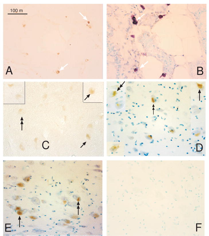 Figure 18