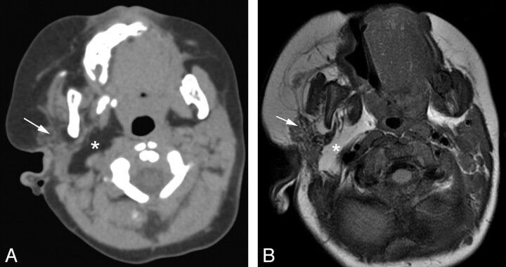 Fig 2.