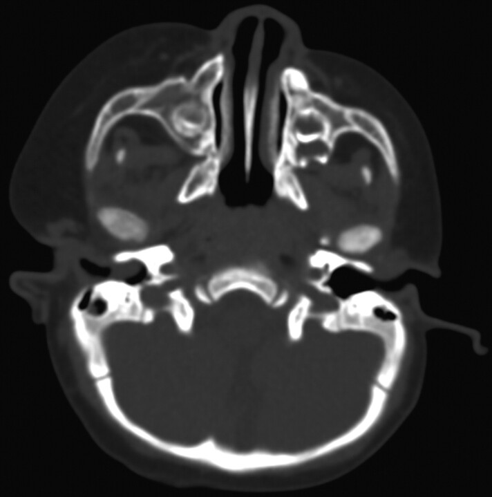 Fig 3.