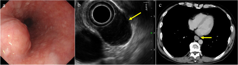 Fig. 1