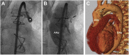 Figure 4