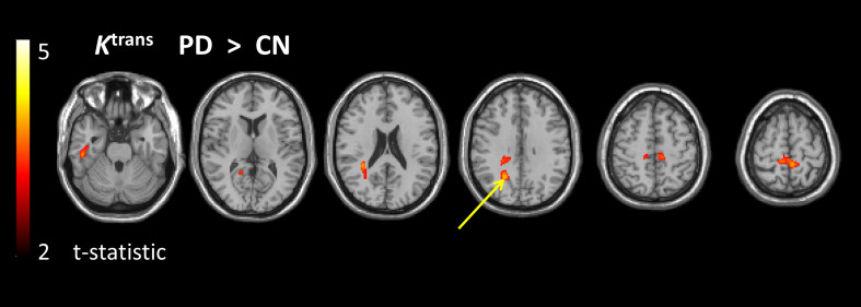 FIGURE 3