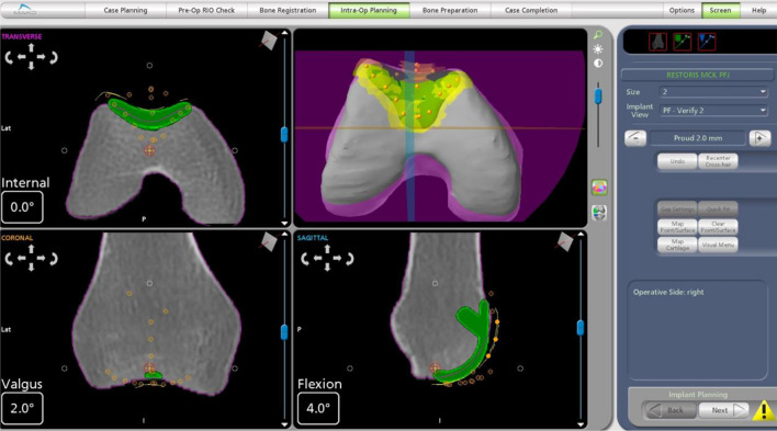 Fig. 12
