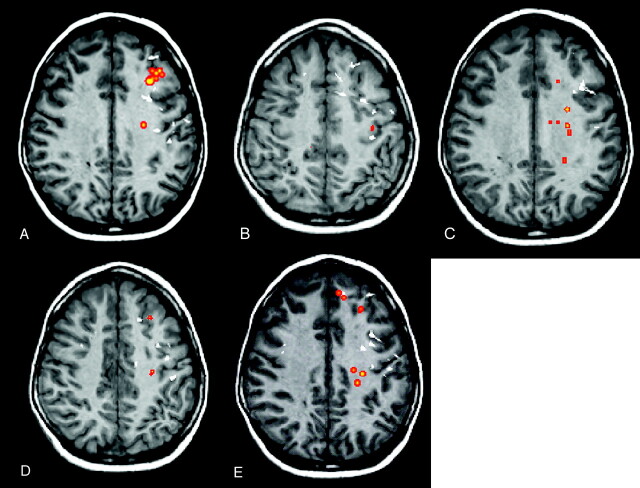 Fig 2.