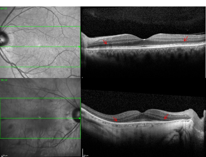 FIGURE 3