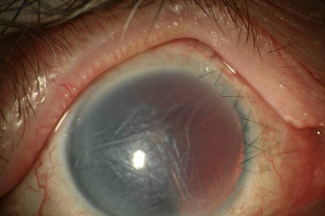 graphic file with name 347_2020_1290_Fig1_HTML.jpg