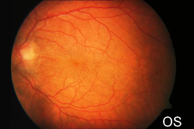 graphic file with name 347_2020_1290_Fig3_HTML.jpg