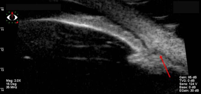 graphic file with name 347_2020_1290_Fig10_HTML.jpg