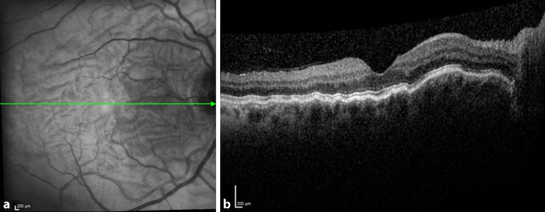 graphic file with name 347_2020_1290_Fig4_HTML.jpg