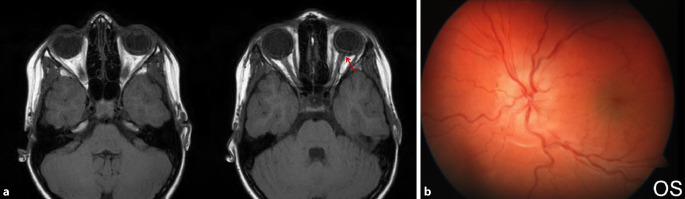 graphic file with name 347_2020_1290_Fig7_HTML.jpg