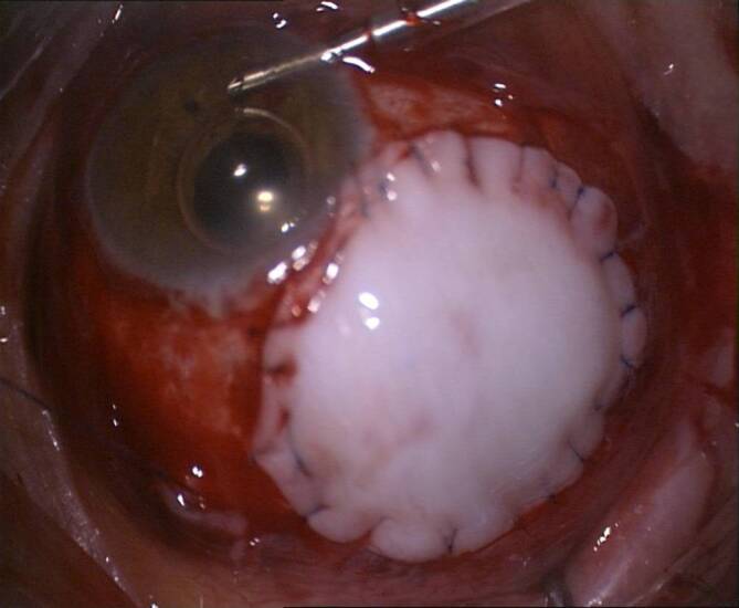 graphic file with name 347_2020_1290_Fig13_HTML.jpg