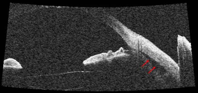 graphic file with name 347_2020_1290_Fig9_HTML.jpg