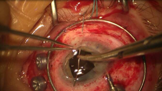 graphic file with name 347_2020_1290_Fig12_HTML.jpg