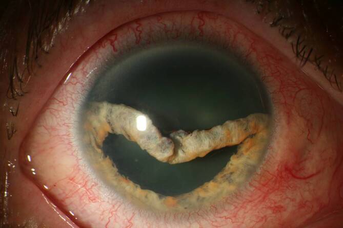 graphic file with name 347_2020_1290_Fig2_HTML.jpg