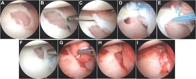 Figure 3