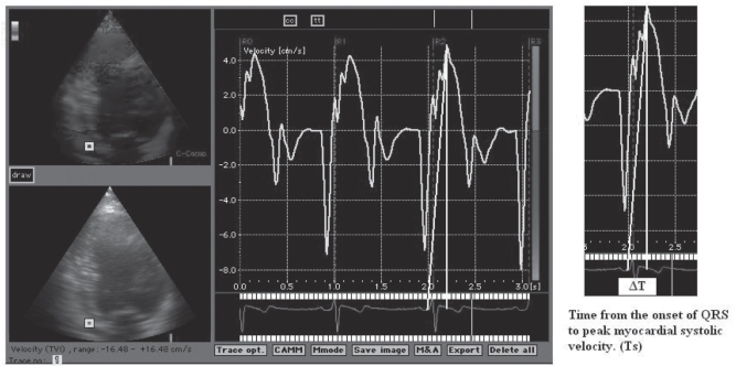 Figure 2)