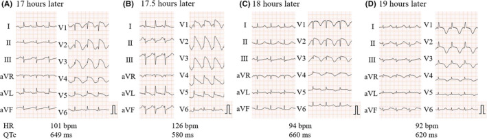 FIGURE 4