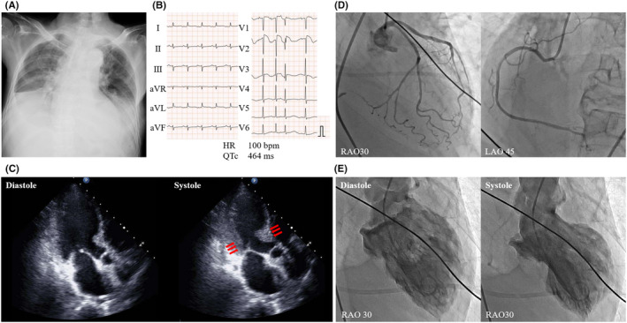 FIGURE 2