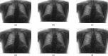 Fig. 16